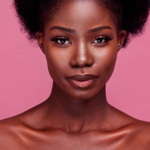 Flakes, Frustration and Black Hair: Tackling Seborrheic Dermatitis