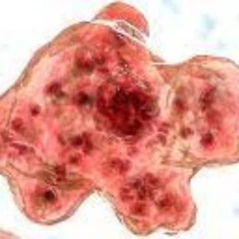 S8 E2: Brain Suckers: The Story of Naegleria fowleri