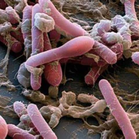 S5 E9: Paralysis on Purpose: The Story of Botulism