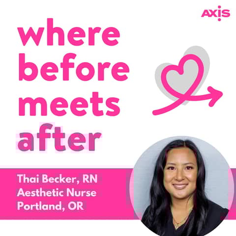 How much filler can you get in a day? [Thai Becker, RN, Portland]