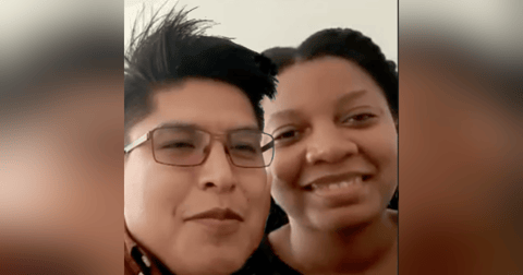 Polycephalic (two headed)twins Polycephalic (two headed)twins