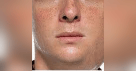 S3 E14: Earache My Eye (Really): The Story of Mumpsvirus S3 E14: Earache My Eye (Really): The Story of Mumpsvirus