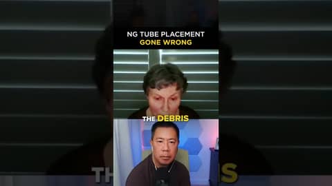 An NG tube placement gone horribly wrong #shorts An NG tube placement gone horribly wrong #shorts