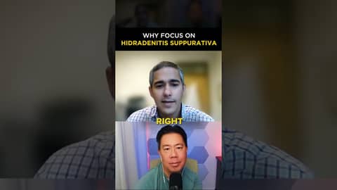 Unlocking the secrets of hidradenitis suppurativa: a journey to help underserved patients #shorts