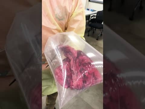 Simulating a pneumothorax for our difficult airway class!