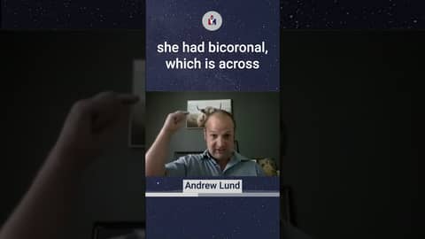 Surging Skull Surgeries: The Shocking Truth