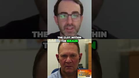 Evolving Stroke Treatment: Promising Minimally Invasive Clot Removal