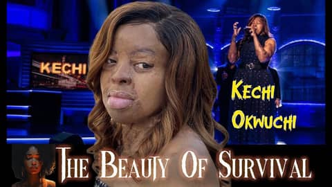 Burned But Not Broken: The Inspiring Story of Kechi Okwuchi