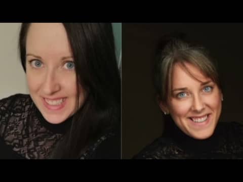 Episode 92 Concussion, PCS and Identical Twins Ashley & Amy Episode 92 Concussion, PCS and Identical Twins Ashley & Amy