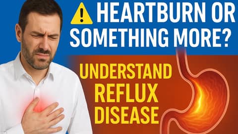 The Silent Burn: Understanding GORD Beyond Heartburn The Silent Burn: Understanding GORD Beyond Heartburn