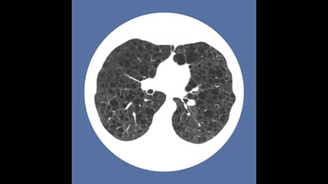 The Man Behind PulmCCM: Great Minds in Medicine