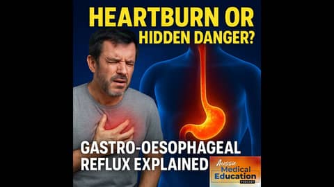 The Silent Burn: Understanding GORD Beyond Heartburn The Silent Burn: Understanding GORD Beyond Heartburn
