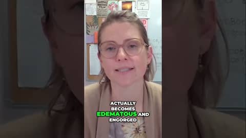 Why Is Your Nerve Swollen? 🤔🚗 Why Is Your Nerve Swollen? 🤔🚗