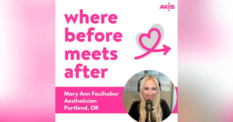 RF Microneedling vs. Microneedling: What’s the Difference? [Mary Ann Faulhaber, Aesthetician, Portland]
