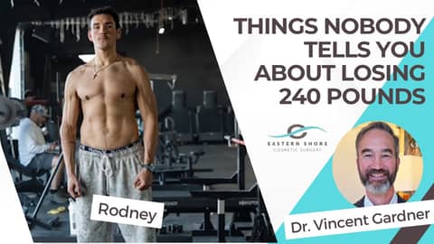 Things Nobody Tells You About Losing 240 Pounds