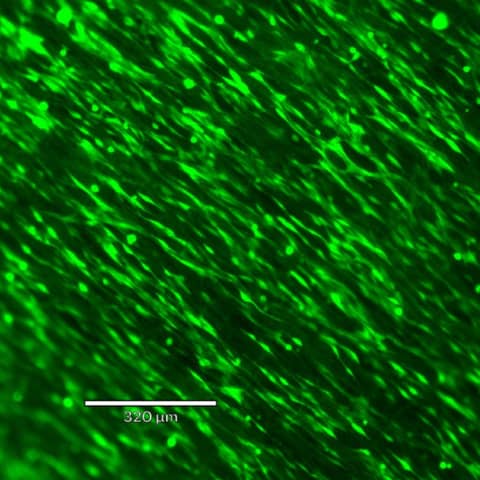 Teryn Wolfe, Matrix F.T.