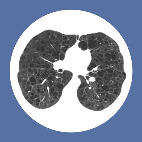 The Man Behind PulmCCM: Great Minds in Medicine