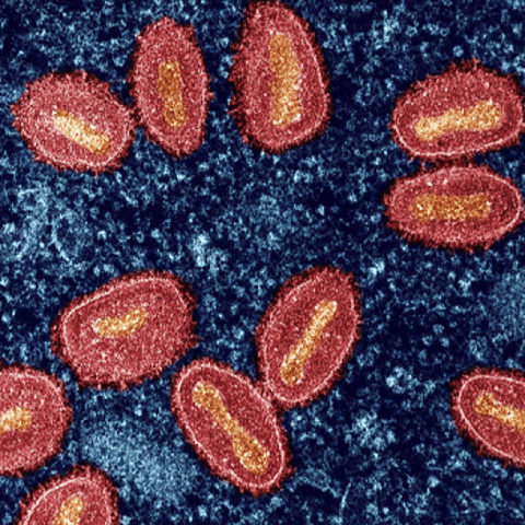 Mpox Outbreak in Sweden Raises Concerns of Wider Spread in Europe