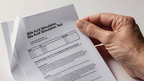 Portosystemic Shunts: When the Bile Acids Don’t Make Sense