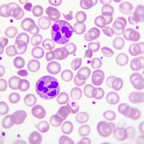 Why Neutrophils are like Spiderman