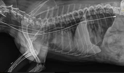 The Very Sneaky, Very Scary NG Tube Complication