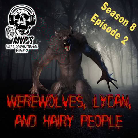 Werewolves, Lycan, and Hairy People S8 E2