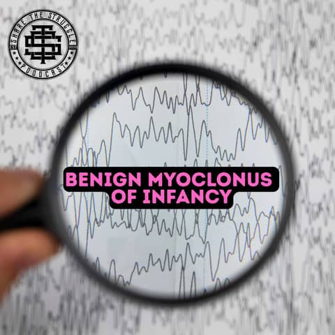 Benign Myoclonus Of Infancy 246