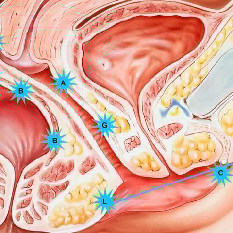 Wellness Part 5:  The Level 7 Orgasm