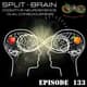 133. Split-Brain 133. Split-Brain