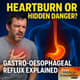 The Silent Burn: Understanding GORD Beyond Heartburn